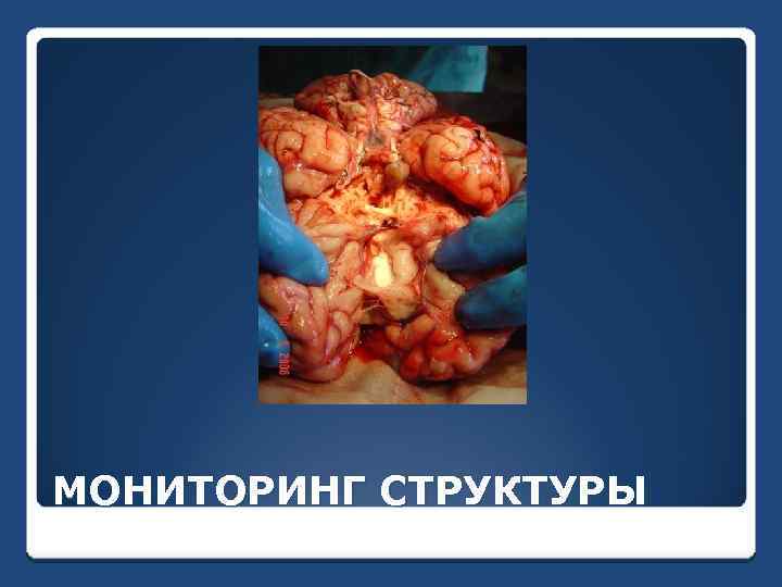 МОНИТОРИНГ СТРУКТУРЫ 