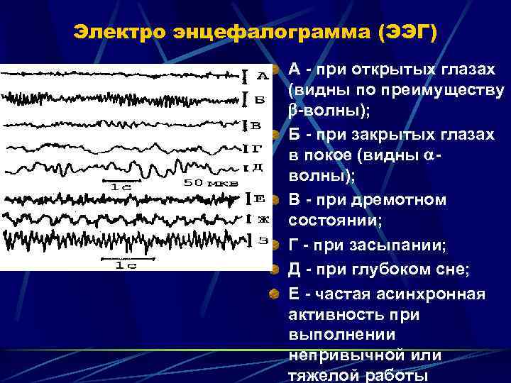 Электро энцефалограмма (ЭЭГ) А - при открытых глазах (видны по преимуществу -волны); Б -