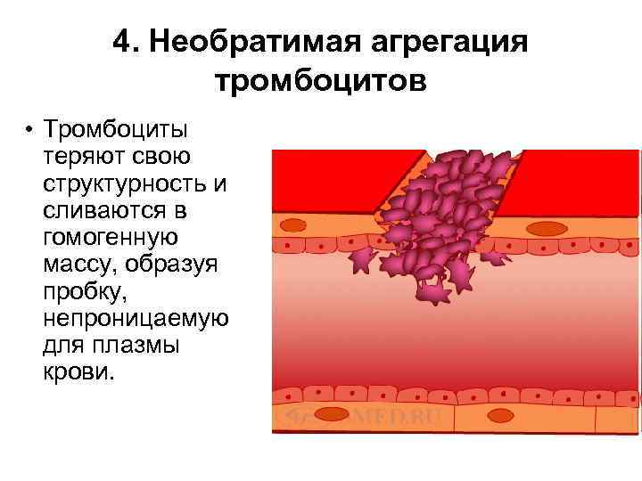 4. Необратимая агрегация тромбоцитов • Тромбоциты теряют свою структурность и сливаются в гомогенную массу,