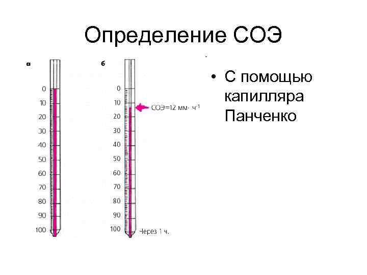 Скорость оседания эритроцитов метод