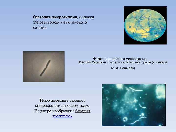 Световая микроскопия, окраска 1% раствором метиленового синего. Фазово-контрастная микроскопия Bacillus Cereus на плотной питательной