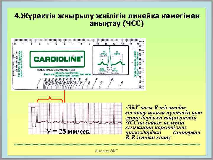 4. Жүректін жиырылу жиілігін линейка көмегімен анықтау (ЧСС) • ЭКГ дағы R тісшесіне есептеу