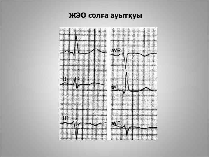 ЖЭО солға ауытқуы 