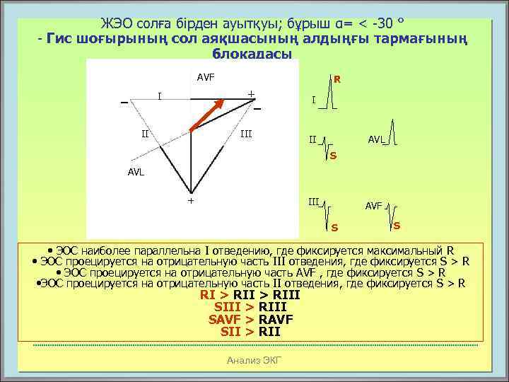 ЖЭО солға бірден ауытқуы; бұрыш α= < -30 ° - Гис шоғырының сол аяқшасының