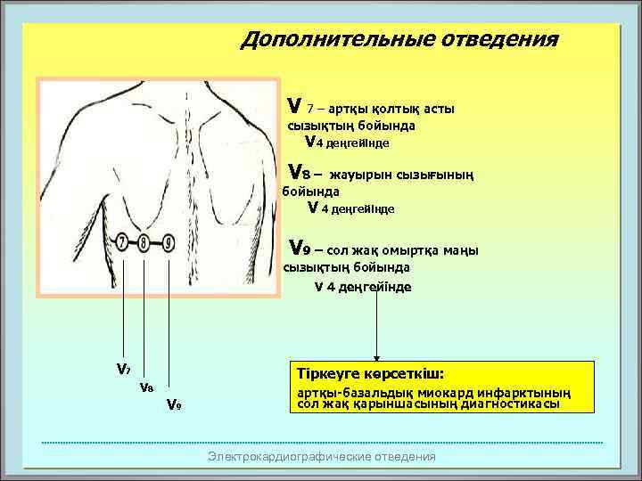 Дополнительные отведения V 7 – артқы қолтық асты сызықтың бойында V 4 деңгейінде V