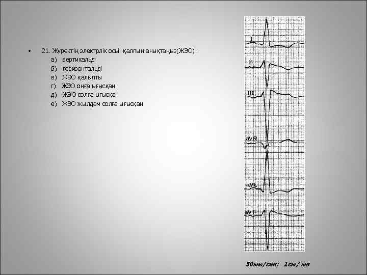  • 21. Жүректің электрлік осьі қалпын анықтаңыз(ЖЭО): а) вертикальді б) горизонтальді в) ЖЭО