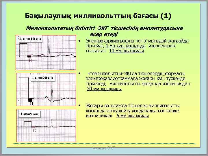Бақылаулық милливольттың бағасы (1) Милливольтатың биіктігі ЭКГ тісшесінің амплитудасына әсер етеді 1 мв=10 мм
