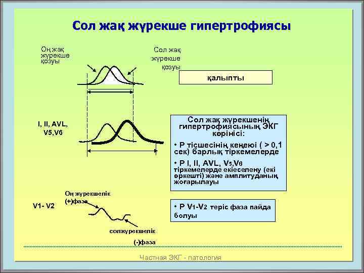 Сол жақ жүрекше гипертрофиясы Оң жақ жүрекше қозуы Сол жақ жүрекше қозуы қалыпты Сол
