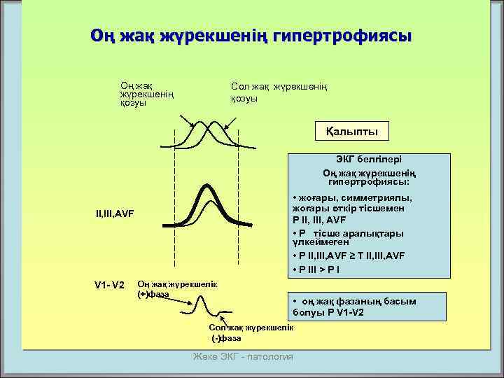 Оң жақ жүрекшенің гипертрофиясы Оң жақ жүрекшенің қозуы Сол жақ жүрекшенің қозуы Қалыпты ЭКГ