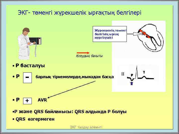ЭКГ- төменгі жүрекшелік ырғақтың белгілері Жүрекшенің төменгі бөлігінің ырғақ жүргізушісі Қозудың бағыты • Р