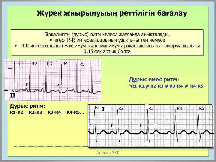 Жүрек жиырылуыың реттілігін бағалау Бірқалыпты (дұрыс) ритм келеси жағдайда анықталады, • егер R-R интервалдарының
