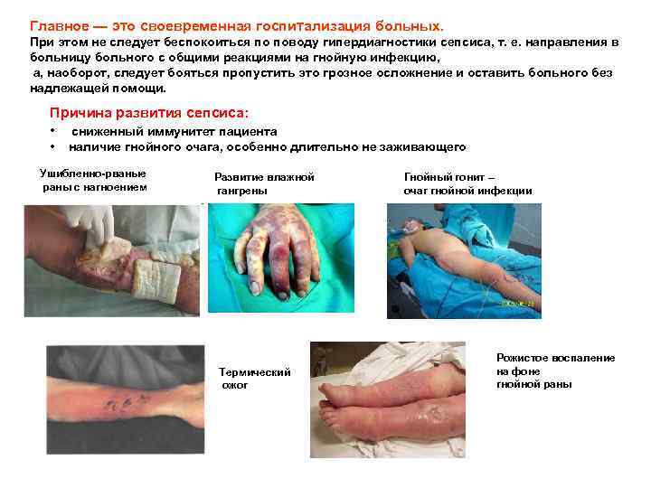 Главное — это своевременная госпитализация больных. При этом не следует беспокоиться по поводу гипердиагностики