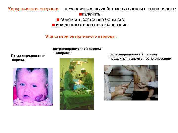 Хирургическая операция – механическое воздействие на органы и ткани целью : излечить, облегчить состояние