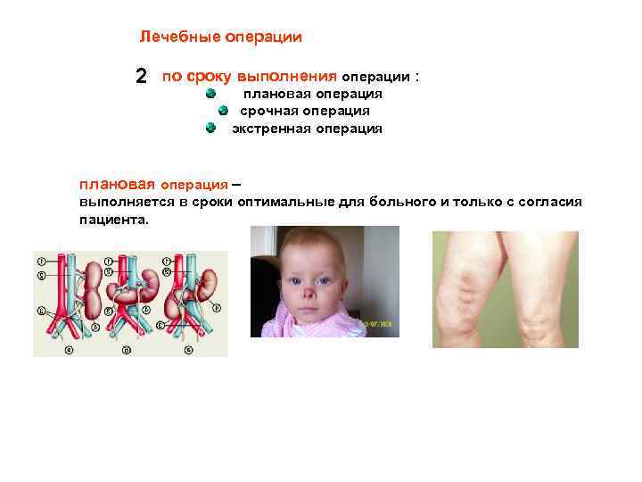 Лечебные операции 2 по сроку выполнения операции : плановая операция срочная операция экстренная операция