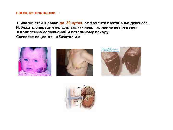 срочная операция – выполняется в сроки до 30 суток от момента постановки диагноза. Избежать