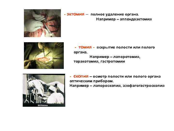 - эктомия – полное удаление органа. Например – аппендоэктомия - вскрытие полости или полого