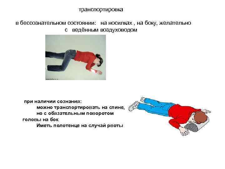 транспортировка в бессознательном состоянии: на носилках , на боку, желательно с ведённым воздуховодом при