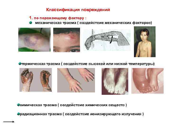 Классификация повреждений 1. по поражающему фактору : механическая травма ( воздействие механических факторов) термическая