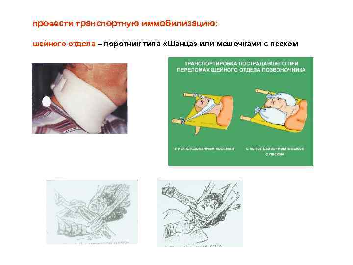 Травма шейного отдела позвоночника иммобилизация