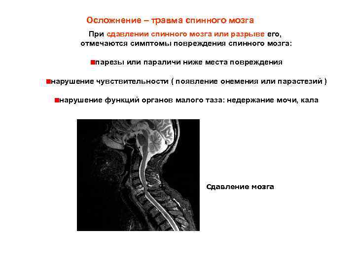 Почему после спинальной. Последствия позвоночно спинномозговой травмы. Ушиб спинного мозга классификация. Осложнения при повреждении позвоночника. Повреждение шейного отдела спинного мозга.