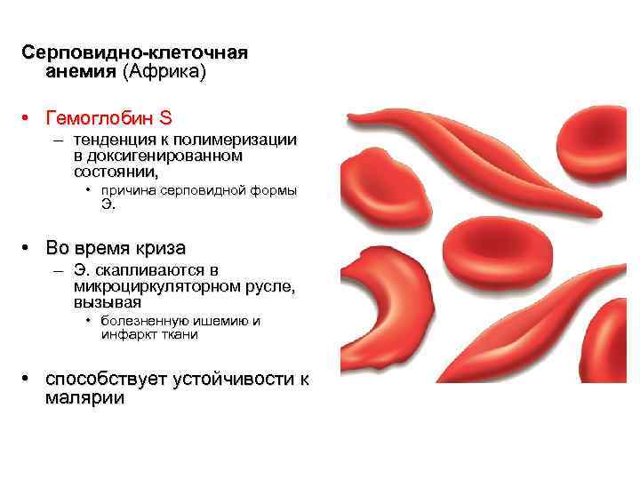 Ген серповидноклеточной анемии. Серповидная анемия эритроциты. Серповидная клеточная анемия гемоглобин. Серповидноклеточная анемия эритроциты форма. Гемоглобин s при серповидноклеточной анемии.
