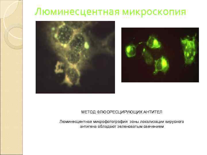 Люминесцентная микроскопия МЕТОД ФЛЮОРЕСЦИРУЮЩИХ АНТИТЕЛ Люминесцентная микрофотография зоны локализации вирусного антигена обладают зеленоватым свечением