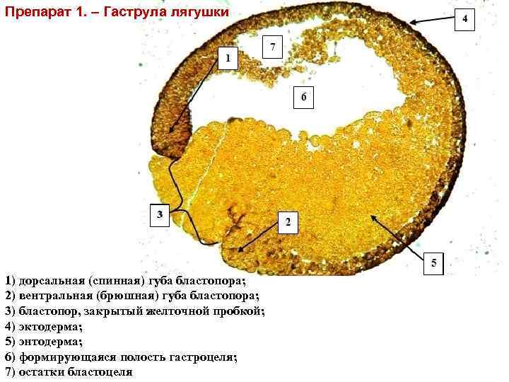 Гаструляция гистология рисунок