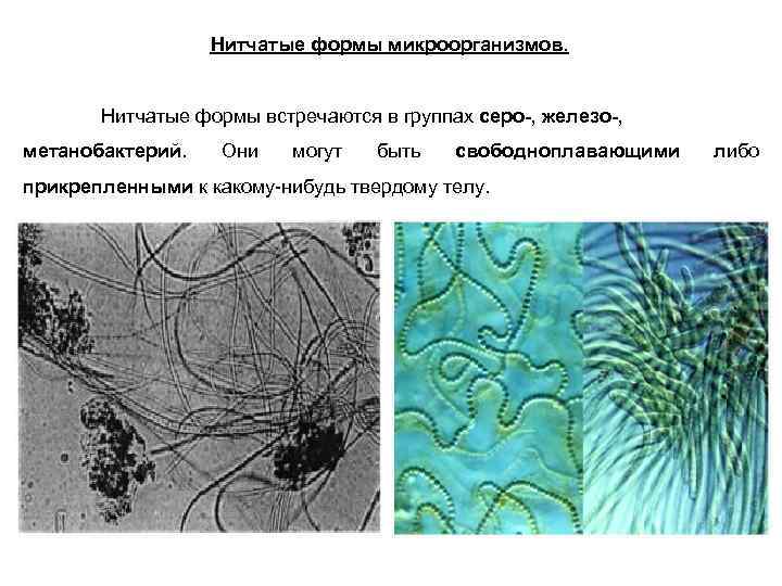 Нитевидные бактерии. Нитчатые формы бактерий. Нитчатые бактерии микробиология. Нитевидные формы бактерий. Ветвящиеся нитевидные формы бактерий.