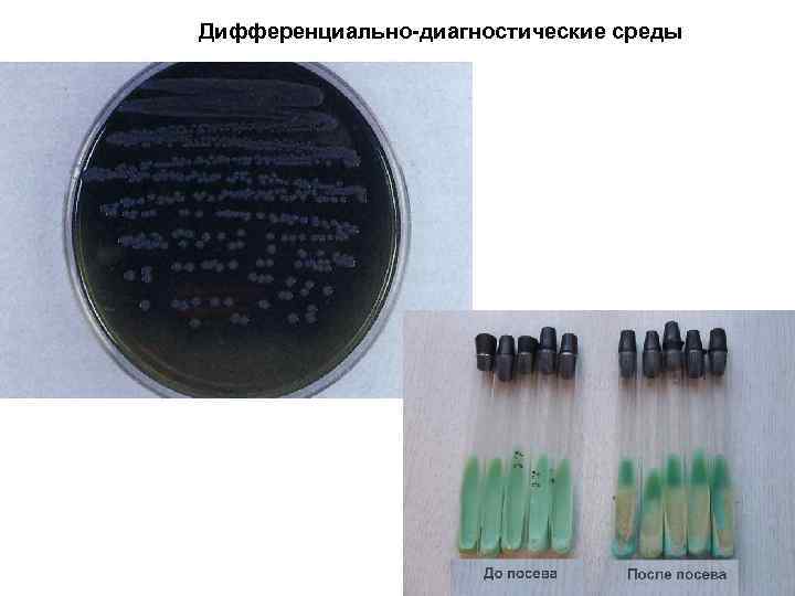 Диагностика среды. Дифференциально-диагностические среды. Среды Гиса. Дифференциально-диагностические среды Эндо. Дифференциально-диагностические питательные среды микробиология. Дифференциально диагностические питательные среды среда Гисса.