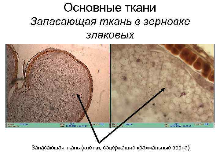 Каким номером на рисунке обозначена внезародышевая запасающая ткань