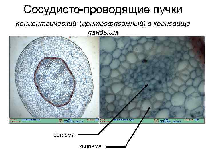 Сосудисто-проводящие пучки Концентрический (центрофлоэмный) в корневище ландыша флоэма ксилема 