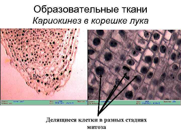Образовательные ткани Кариокинез в корешке лука Делящиеся клетки в разных стадиях митоза 
