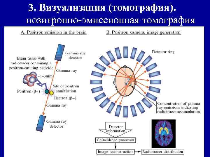 3. Визуализация (томография). позитронно-эмиссионная томография 