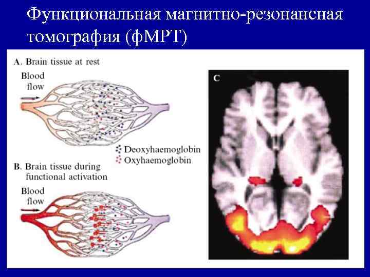 Функциональная магнитно-резонансная томография (ф. МРТ) 