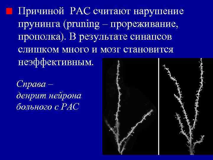 Причиной РАС считают нарушение прунинга (pruning – прореживание, прополка). В результате синапсов слишком много