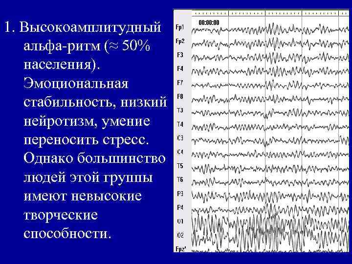 1. Высокоамплитудный альфа-ритм (≈ 50% населения). Эмоциональная стабильность, низкий нейротизм, умение переносить стресс. Однако