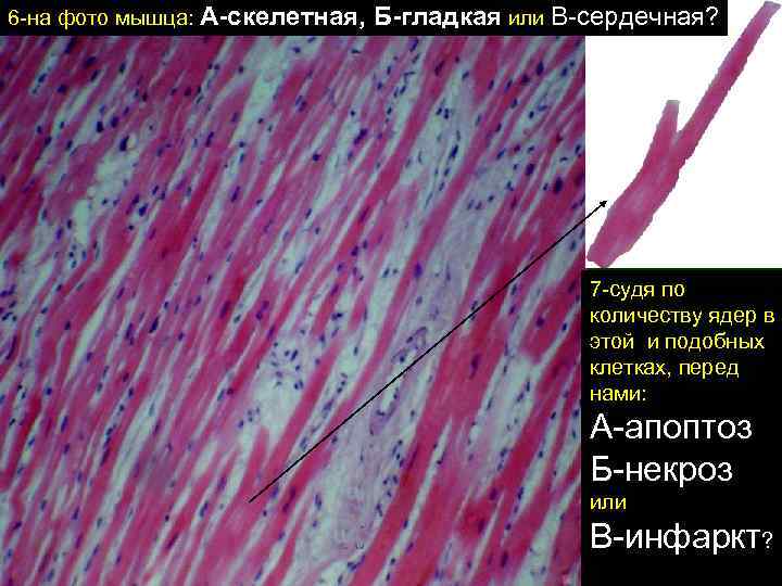 6 -на фото мышца: А-скелетная, Б-гладкая или В-сердечная? 7 -судя по количеству ядер в