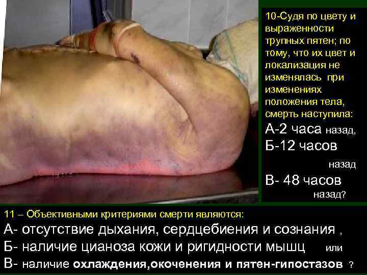10 -Судя по цвету и выраженности трупных пятен; по тому, что их цвет и