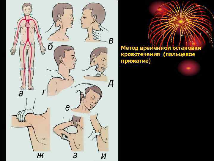 Временной остановки