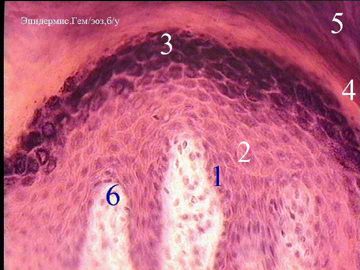 Эпидермис фото на человеке