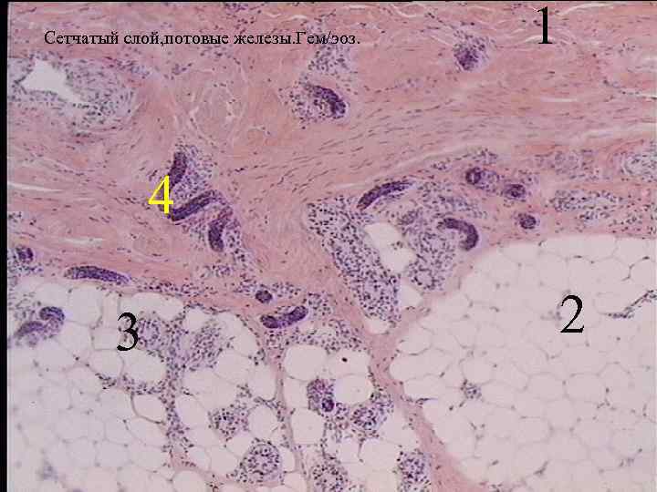 Сетчатый слой, потовые железы. Гем/эоз. 1 4 3 2 