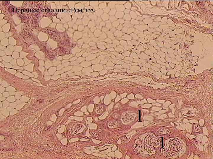 Нервные стволики. Гем/эоз. 1 1 