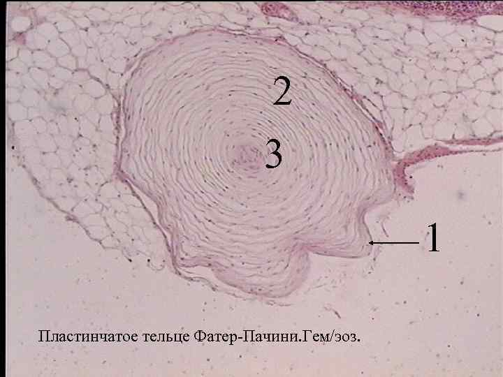 2 3 1 Пластинчатое тельце Фатер-Пачини. Гем/эоз. 