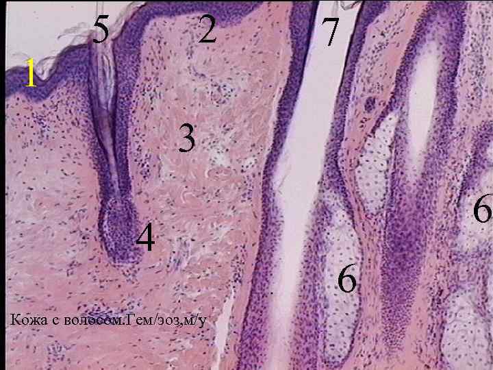 1 5 2 7 3 4 Кожа с волосом. Гем/эоз, м/у 6 6 