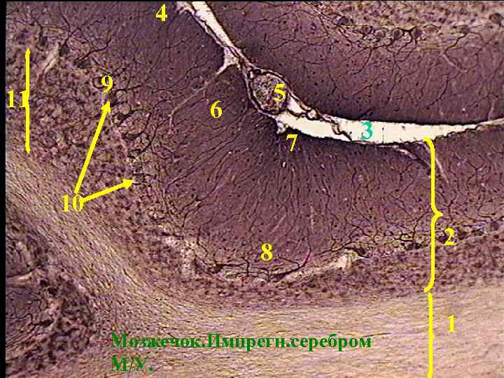 4 9 11 5 6 7 3 10 8 Мозжечок. Импрегн. серебром М/У. 2