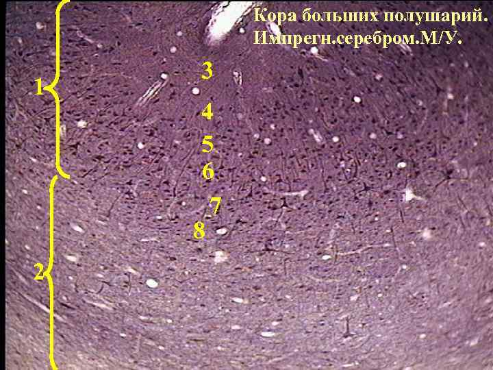 По изображению с микроскопа в препарате коры больших полушарий импрегнированном нитратом серебра