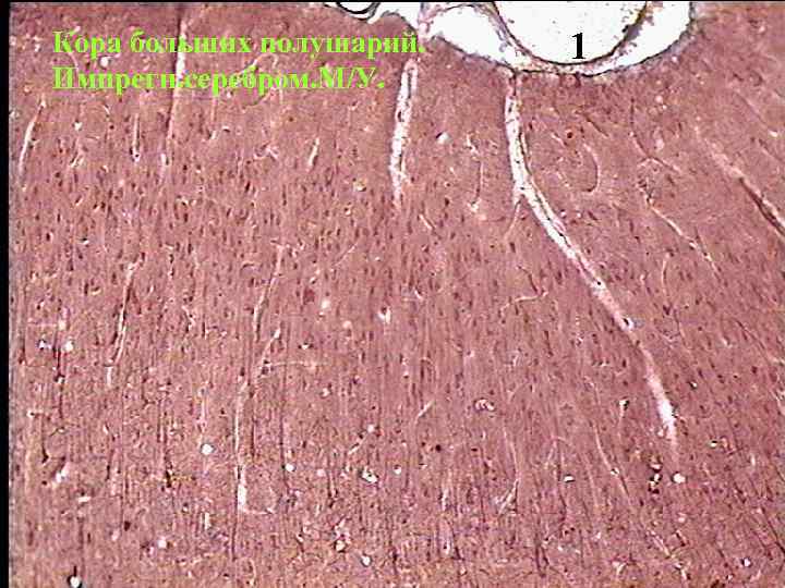 Кора больших полушарий гистология препарат рисунок