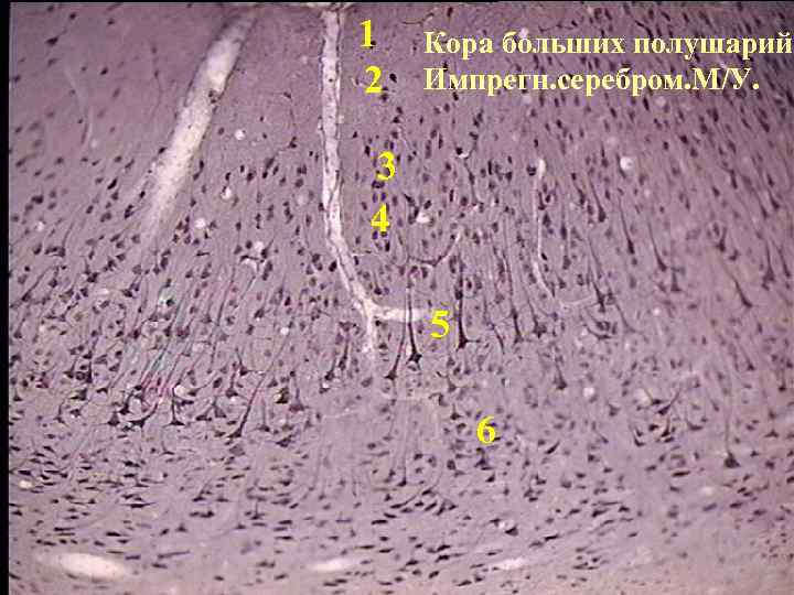 По изображению с микроскопа в препарате коры больших полушарий импрегнированном нитратом серебра
