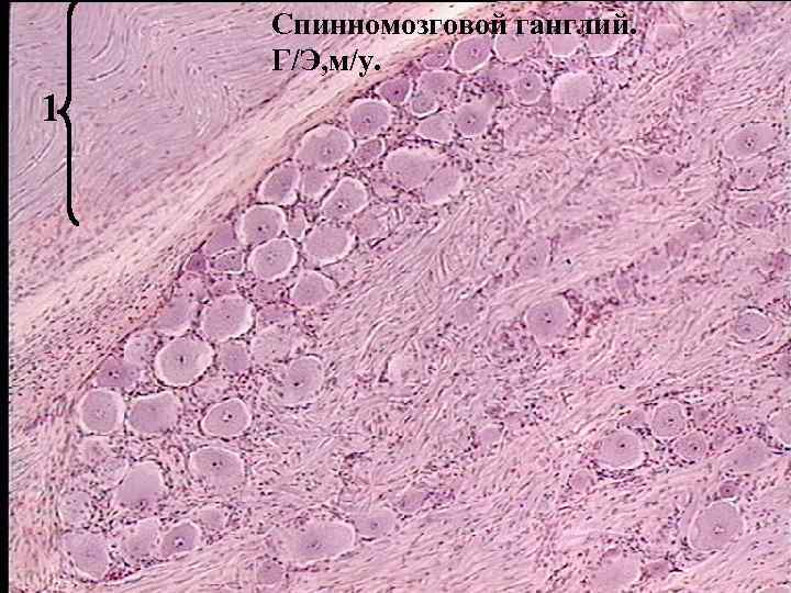 Спинномозговой ганглий. Г/Э, м/у. 1 