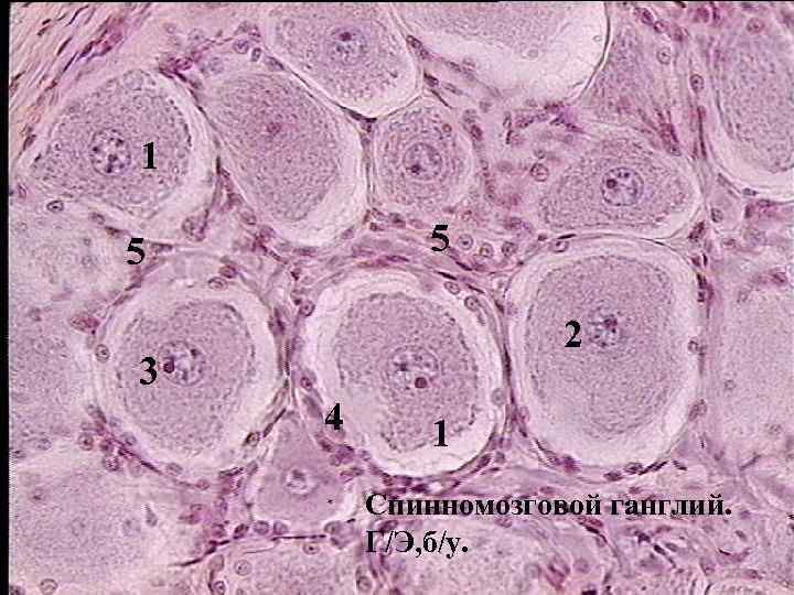 1 5 5 2 3 4 1 Спинномозговой ганглий. Г/Э, б/у. 